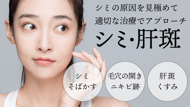 カンナム美容外科のシミ取り治療について